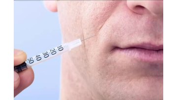 PLLA dermal fillers for male treatment youthful look