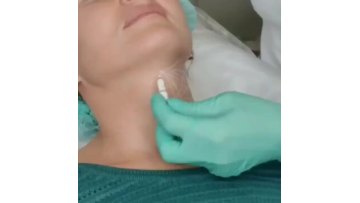 Reborn PLLA Dermal Filler For Neck Rejuvenation