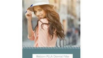 dermal filler before and after