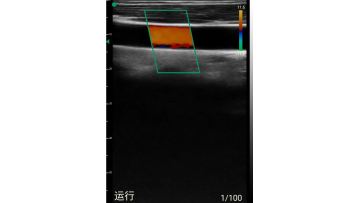 USB linear probe