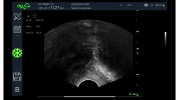 color ultrasound
