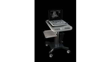 Notebook Ultrasound Scanner
