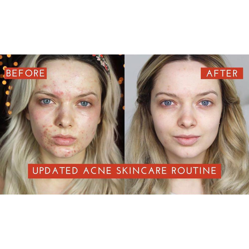 Pixi 250ml 5% Glycolic Acid Glow Tonic Moisturizing Oil-controlling Essence Toners Astringent for Female Makeup Face Care