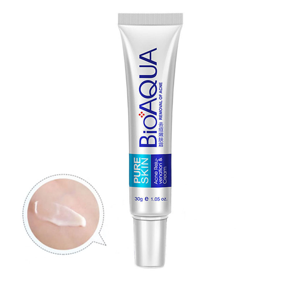 BIOAQUA Anti Acne Cream Removal Of Acne Removal Of Blackheads Whitening Cream Scar Remove Reduce Acne Oil Control Shrink Pores