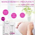 Mango Remove Pregnancy Acne Scar Stretch Mark Cream Treatment Maternal Anti-Aging Repair Anti-Wrinkle Firming Body Cream TSLM2