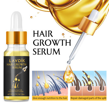 Ginger Fast Hair Growth Serum Essential Oil Anti Preventing Hair Lose Liquid Damaged Hair Repair Growing Anti-Hair Loss Conditio