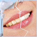 6pcs Teeth Whitening kit Nano Tube Teeth Cleaning Whitener Brush Tooth Stains Remover Teeth Cleaning Strips for Oral Deep Clean