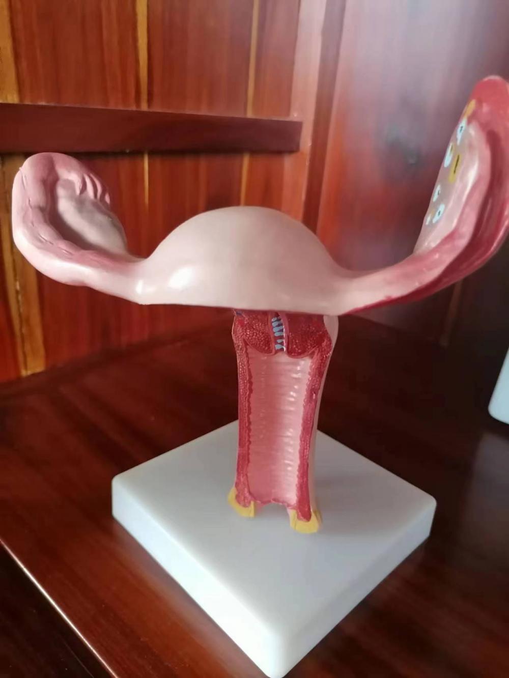 Uterus Model with Pathology