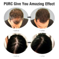 PURC Hot sale Fast Hair Growth Oil Hair Loss Treatment Help for hair Growth Hair Care Ginger Extract 20ml TSLM2