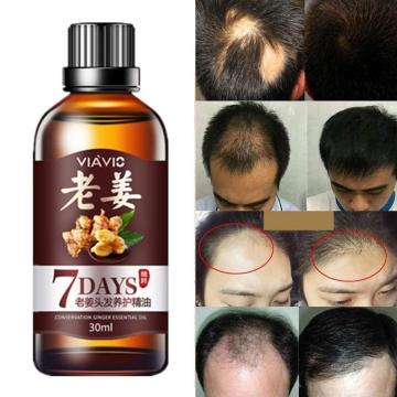 30ml Fast Hair Growth Dense Regrowth Ginger Serum Oil Anti Loss Treatment Essence Bin Women and Men Anti preventing Hair Loss