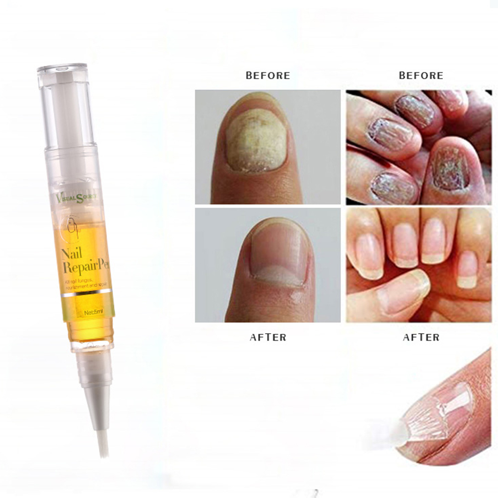 5ml Nail Cuticle Oil Pen Onychomycosis Paronychia Nail Treatments Anti Toenail Fungus Nail Nail Oil Products TSLM2