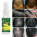 30ml Ginger Hair Care Growth Essence Oil Hair Loss Treatment Adult Hair Loss Products Naturally With No Side Effects Grow