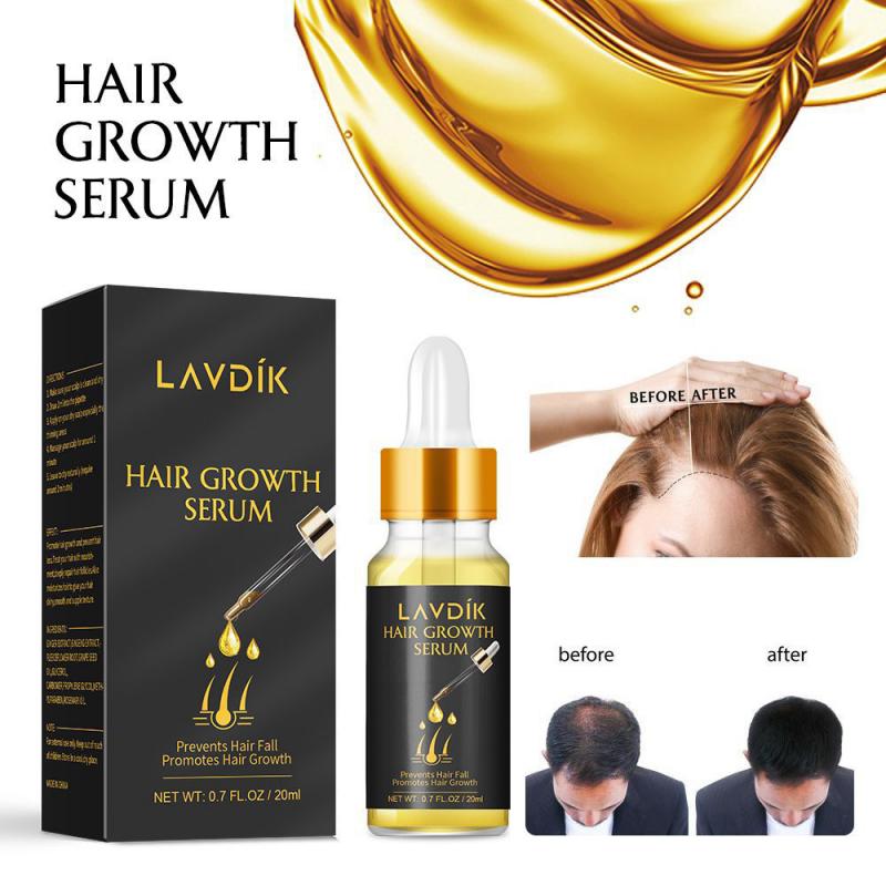 LAVDIK Ginger Fast Hair Growth Serum Essential Oil Anti Preventing Hair Lose Liquid Damaged Hair Repair Growing Dropship TXTB1