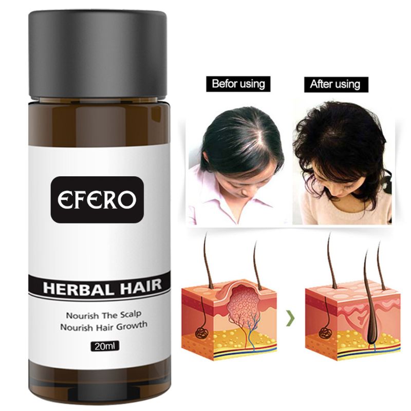 20ml Natural Herbal Ginger Extract Hair Grow Serum Prevents Baldness Anti Hair Loss Scalp Nourishing Essential Oil