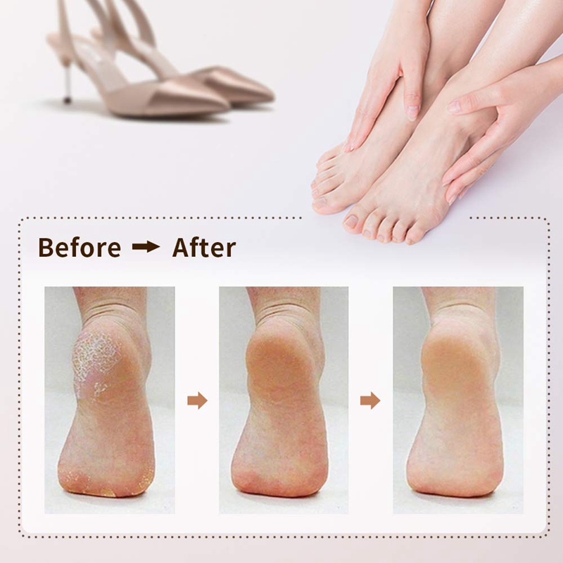 Hot Electric Callus Remover Rechargeable Electronic Feet File Pedicure Foot File Foot Rasp with IPX7 Waterproof Design for Dry C
