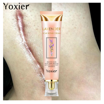 20g Remover Acne Scar Stretch Cream Marks Repair Acne Spots Acne Treatment Face Cream Blackhead Skin Care Whitening Cream