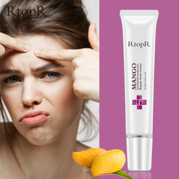Mango Repair Acne Cream Anti Acne Spots Acne Treatment Scar Blackhead Cream Shrink Pores Whitening Moisturizing Face Skin Care