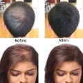 Sevich 10 Colors Keratin Hair Fiber Powder 50g/100g Refill Bag Hair Building Fiber Powder Hair Loss Products