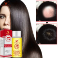 MeiYanQiong 20ML Fast Powerful Hair Growth Essence Hair Loss Products Essential Oil Liquid Treatment Preventing Hair Loss Hair