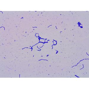 Health Benefits 400 Billion CFU/g Lactobacillus Paracasei