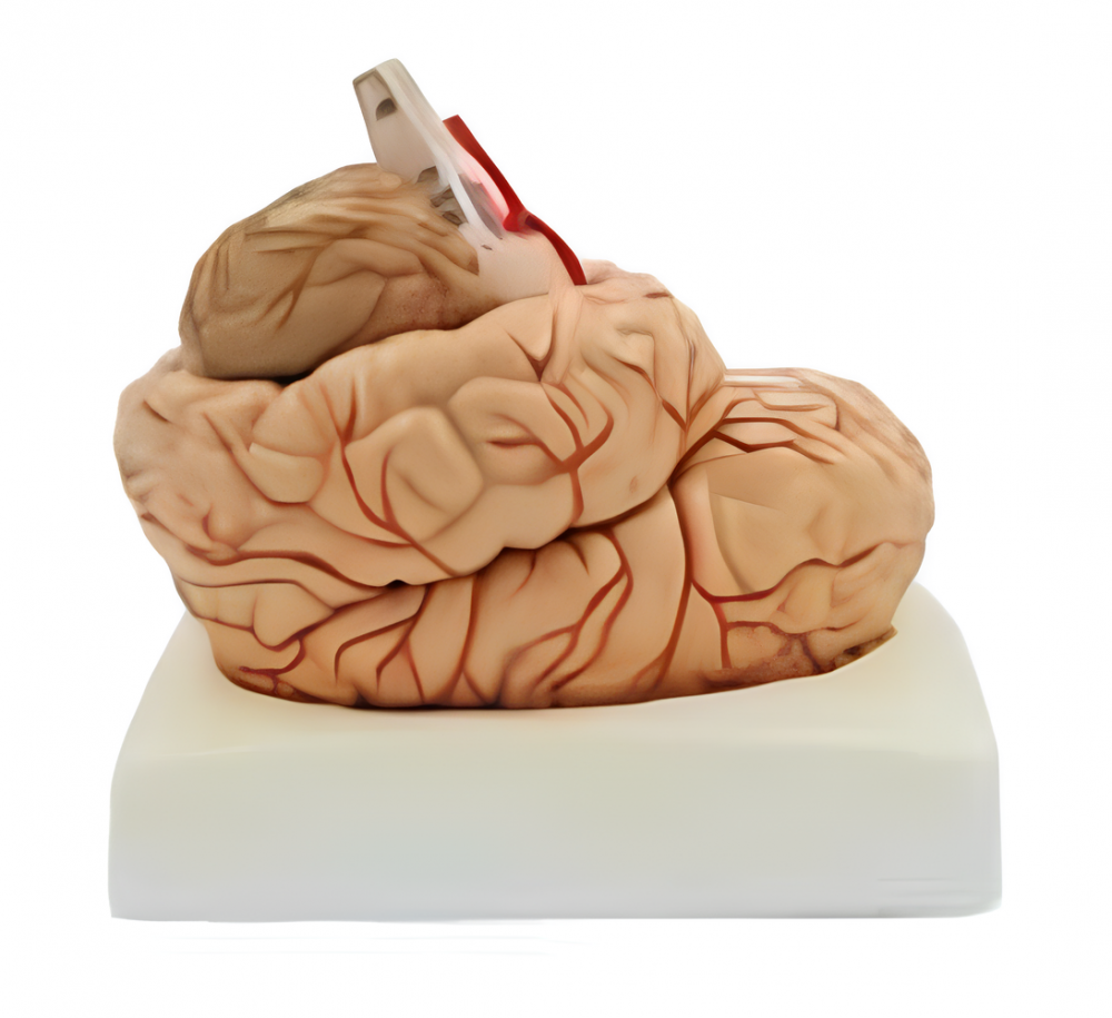Brain with Artery and Nerves