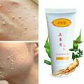 Exfoliating Gel Scrubs Peeling Dead Skin Removal Gel For Face And Body Skin Care Peeling Cleanser Exfoliating