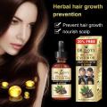 Fast Hair Growth Remedy Essence Oil Oriental Oils Hair Nutrition Hair Loss Treatment Solutions Product Hair Regrowth Product50ml