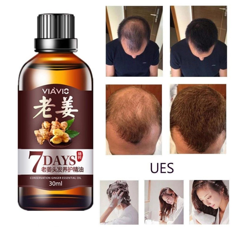 Fast Hair Growth Dense Regrowth Ginger Serum Oil Anti Loss Treatment Essence Hair Care