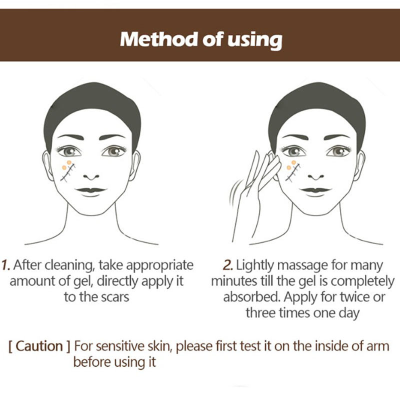 Cayman Serum Women Skin Scar Acne Estrias Mark Removal Gel Face Body Acne Postpartum Repair Crema Hidratante Facial Pimple Patch