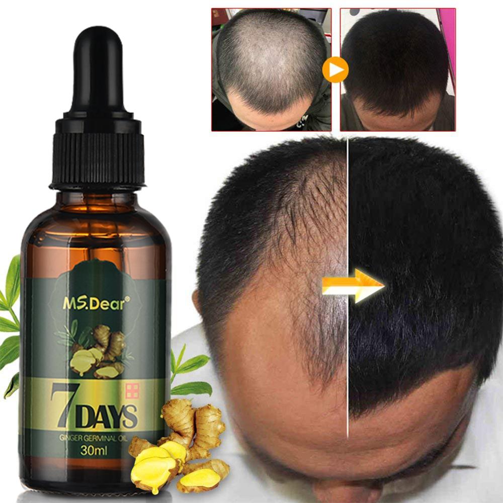 Hair Growth Essential Oils Ginger Germinal Oil Fast Hair Growth Anti-Hair Loss Alopecia Treatment Beauty Dense Hair Growth Serum