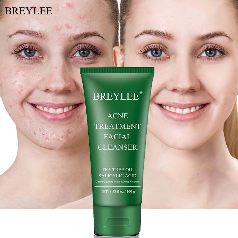 BREYLEE Acne Treatment Facial Cleanser Tea Deep Cleaning Whitening Shrink Pores Oil Control Remove Blackhead Moisturizing Care