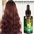 30ml Ginger Hair Growth Nutrient Solution Hair Loss Nutrition Moisturizing Treatment Repairing Essential Oil Scalp Protecti H0I3