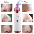 Pore Vacuum Blackhead Remover Suction Acne Peeling Pore Face Cleanser Facial Skin Care Diamond Microdermabrasion Beauty Machine
