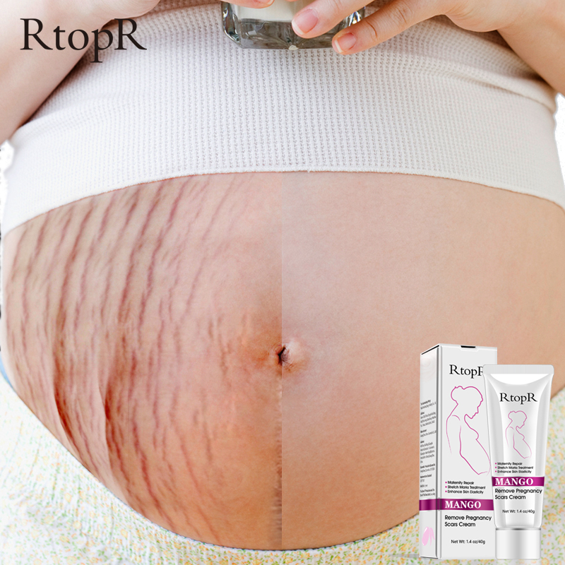 New Remove Pregnancy Scars Cream Maternity Pigment Correction Repair Body Gel Firming Lifting Brighten Stretch Marks RtopR 40g