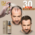 PURC New Hair Growth Spray Fast Grow Hair Loss Treatment For Thinning Preventing Hair Loss 30ml