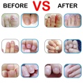 2PCS Effectively Eliminate Nail Fungus Pen 3ml Onychomycosis Paronychia Herbal Toe Finger Nails Infection Medicinal TSLM1