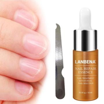 15ML Fungal Nail Treatment Nail Repair Serum Remove Onychomycosis Hands Feet Care of Toe Nail Nourishing Brighten