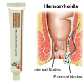 Herbal Hemorrhoids Cream Internal Hemorrhoids Piles External anal Fissure Treatment Body Skin Care Day Cream Drop shipping