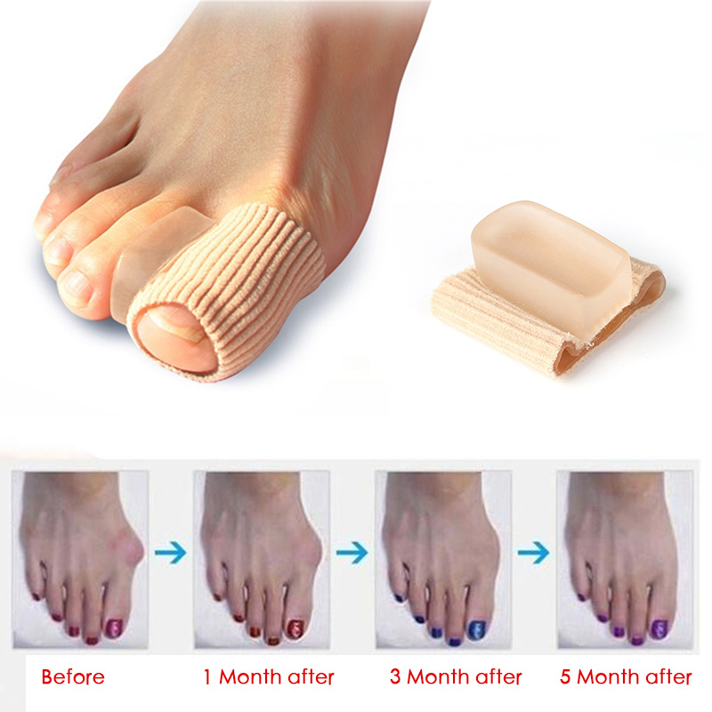 1 Pc Toe Separator Feet Care Special Hallux Valgus Thumb Bent Toes Orthopedic Deliver Braces Correct Daily Silicone Nail New