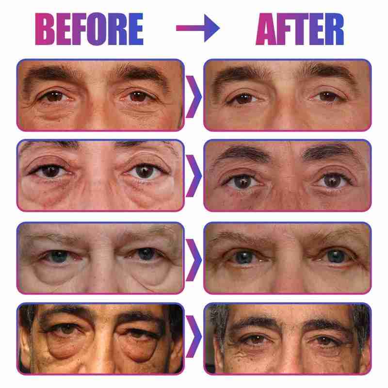 30g Men Eye Cream Eye Anti Aging Wrinkle Moisturizing Nourishing Remove Dark Eye Circles Lighten Pouch Essence