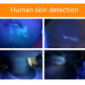 Lightweight Hand-Held Wood's Lamp Wavelength Ultraviolet Diagnostic UV Skin Fungal Detection Analyzer +flashlight Function