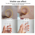 Aqua Peel Hydra Light Bubble Equipment Water Oxygen Injection Jet Peel Deep Cleaning Blackhead Removal Facial Beauty Salon