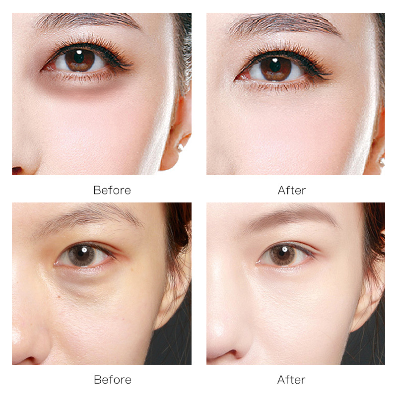 60pcs Gold Caviar Eye Mask Collagen Moisturizing Remove Dark Circles Anti-Aging Skin Care