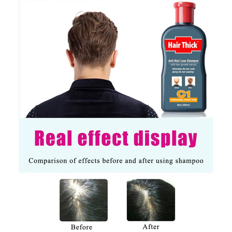Hair Growth Serum Hair Loss Products Oil Control Anti-dandruff Relieve Itching Unisex 100ml Anti-hair Loss Shampoos