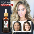 Hair Nutrition Hair Loss Treatment Solutions Product Fast Hair Growth Remedy Essence Oil Hair Regrowth Products Hair Growth