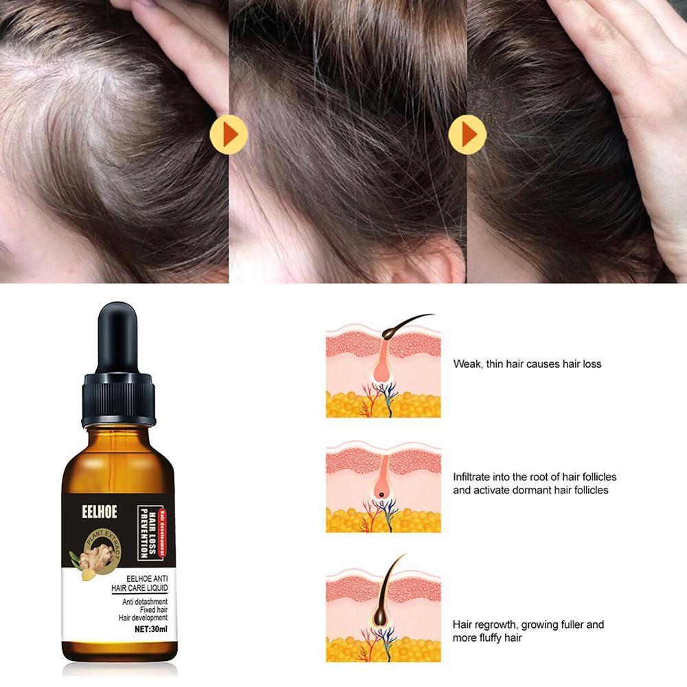 Hair Growth Essential Oils Ginger Germinal Oil Fast Anti-Hair Loss Dense Alopecia Hair Hair Serum Beauty Growth Treatment G D9C6