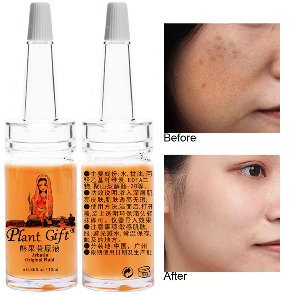 10ml*pcs Arbutin Original Fluid Stoste Liquid Skin Lightening Whiten Fleck Anti Freckles Liver Spots Hyperpigmented Area