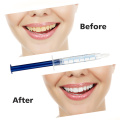Teeth Whitening Kit 44% Peroxide Dental Bleaching System 10pcs Oral Gel Set Tooth Whitener Dental Tooth Care Dropshipping