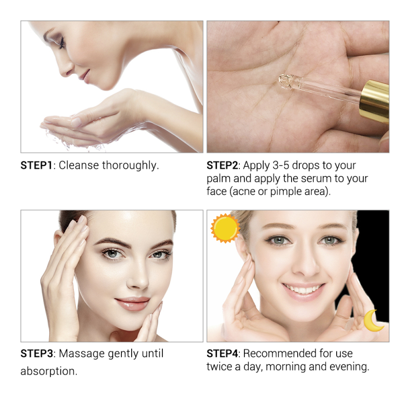 17ML Acne Treatment Face Serum Mask Anti Acne Pimple Scar Remover Moisturizing Whitening Skin Care Facial Essence Cream