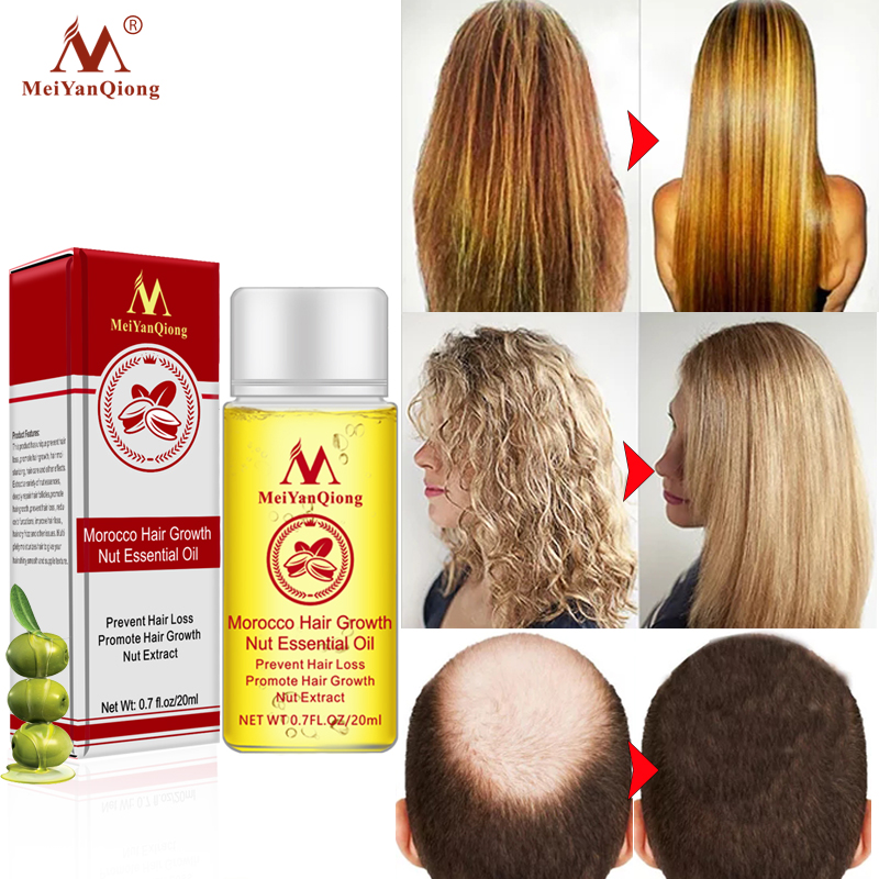 MeiYanQiong 20ML Fast Powerful Hair Growth Essence Hair Loss Products Essential Oil Liquid Treatment Preventing Hair Loss Hair